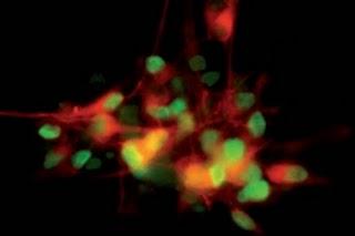 Células madre para desentrañar los misterios del Parkinson