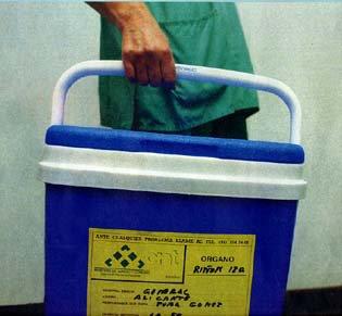 Tipos de rechazo de órganos y factores que influyen en él. La compatiblidad.