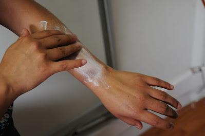 RECOMIENDA SALUD PREVENIR DAÑOS EN PIEL Y ENFERMEDADES GASTROINTESTINALES DURANTE TEMPORADA DE CALOR