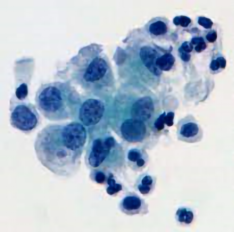 Crónicas del Campo Santo, Crónica Nº 25 Crónicas del Campo Santo, Crónica Nº 25