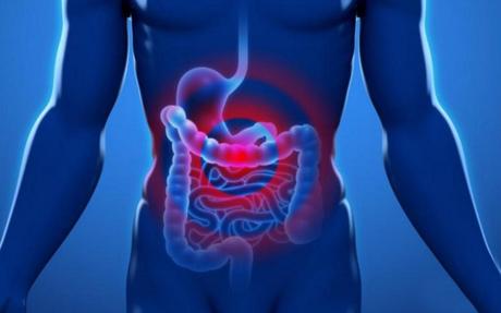 ¿Qué es la peritonitis? riesgos que implica