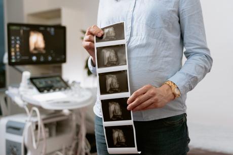 El porqué de las ecografías y cuántas deben realizarse durante el embarazo