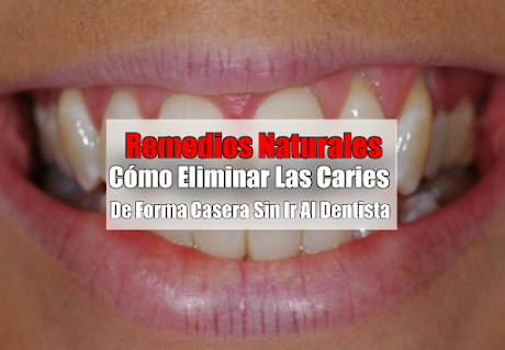 Cómo Eliminar Las Caries De Forma Casera Sin Ir Al Dentista