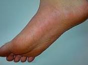 fibrilación auricular puede diagnosticar pies Diabeticos