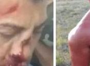 Presos molieron golpes fisicoculturista acusado asesinar pareja: desfiguraron