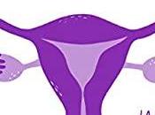 Opinión endometriosis doctor francisco carmona