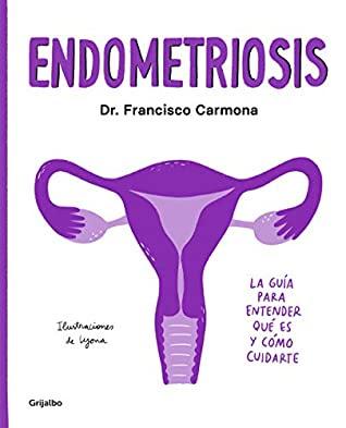 OPINIÓN DE ENDOMETRIOSIS DEL DOCTOR FRANCISCO CARMONA OPINIÓN DE ENDOMETRIOSIS DEL DOCTOR FRANCISCO CARMONA