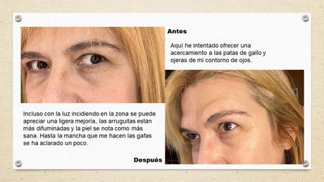 Probando K-Beauty de Cosrx y Benton