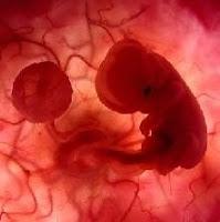 ¿Que causa los Abortos Expontaneos?