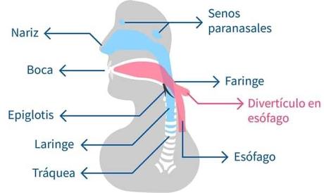 DIVERTICULO DE ZENKER