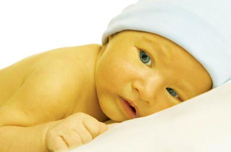 Ictericia neonatal ¿Qué es y cómo se trata?