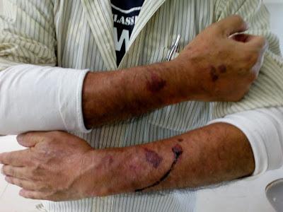 CON SAÑA APLICAN “SEGURIDAD” POLICÍAS MUNICIPALES DE TEXCOCO