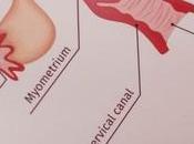 Discapacidad según para