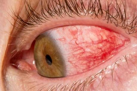 Crónicas del Campo Santo Nº 33