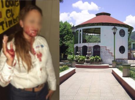 Candidata a regidora en Tamasopo fue golpeada por un sujeto