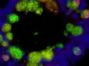 ¿Porque comer azúcar grasa deteriora sistema inmunológico?