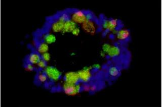 ¿Porque comer azúcar y grasa deteriora el sistema inmunológico? ¿Porque comer azúcar y grasa deteriora el sistema inmunológico?