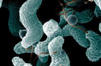 El Campylobacter y la Shigella se transmiten por contacto sexual