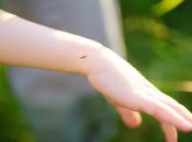 consejos para proteger piel hijos aliviarla caso picaduras