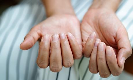¿Cómo fortalecer las uñas? uñas-quebradizas