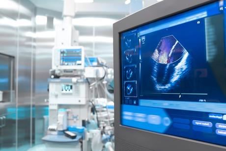 Ventajas e inconvenientes de las ecografías
