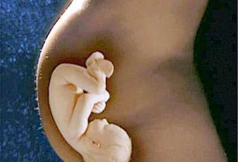 La grasa de la madre puede dañar el embrión