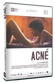 Llega a las tiendas 'Acné', de la mano de Avalon