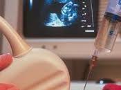 Como realiza amniocentesis durante embarazo