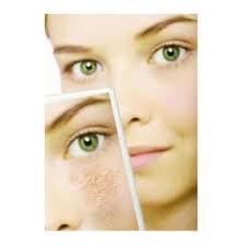 Borra las marcas dejadas por el acné