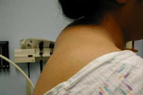 El Laboratorio Géomer Pure Nature revoluciona el sector de los tratamientos para la joroba de búfalo