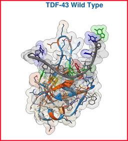 Vacuna Pfizer relacionada con Alzheimer