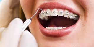 Problemas que puede causar la ortodoncia mal aplicada