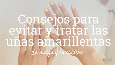 Consejos para evitar y tratar las uñas amarillentas Consejos para evitar y tratar las uñas amarillentas