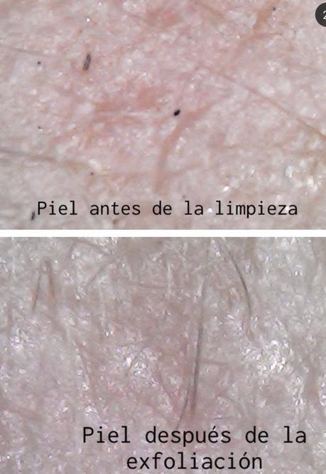 Piel (y pelos) bajo el microscopio.