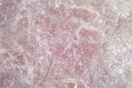 Piel (y pelos) bajo el microscopio.