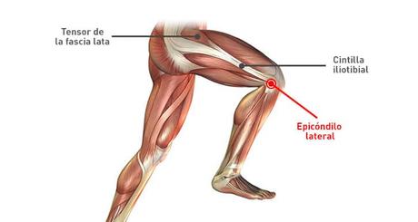 Dolor en la rodilla en la cara externa