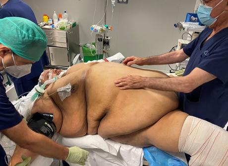 Emilio Jesús Jiménez, una vida con 308 kilos