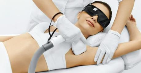 Depilación láser, todo lo que necesitas saber