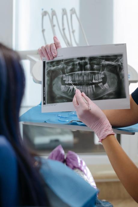 Incrementa la necesidad de implantes y endodoncias en las revisiones dentales según Dental Company