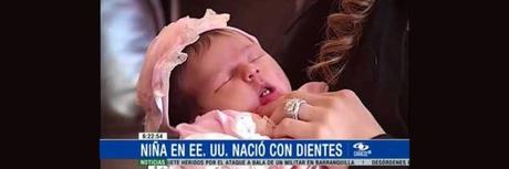 Bebés nacen con dientes