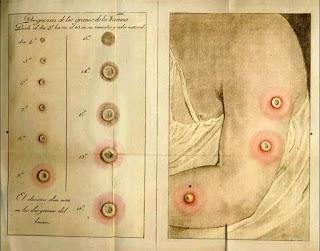 La expedición salvadora