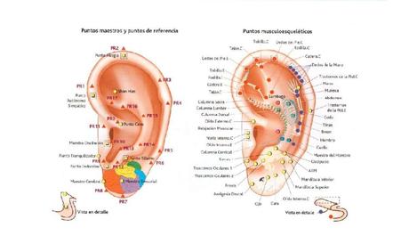 Auriculoterapia. Qué es. Mapa y puntos. Sus usos para adelgazar, ciática, dejar de fumar, ansiedad y el insomnio 2 auriculoterapia puntos