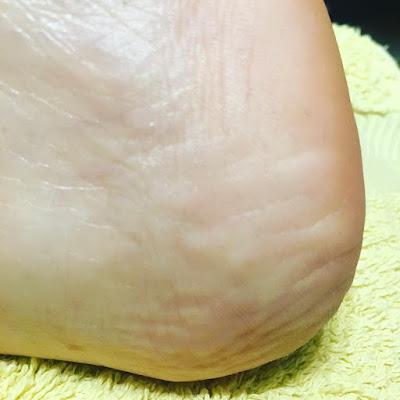 Viernes De Spa, Pies y Cara.