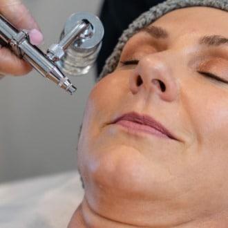 oxigenoterapia facial