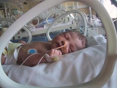 Bebés prematuros