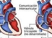 Cardiopatías congénitas severas niños bajo peso nacer