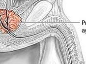 Respuesta Negligencia Médica