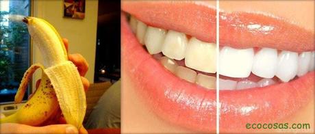 Cómo blanquear los dientes de forma natural y casera 2 aceite de coco para los dientes