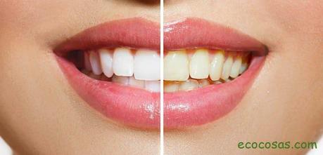 Cómo blanquear los dientes de forma natural y casera 4 como blanquear los dientes en casa