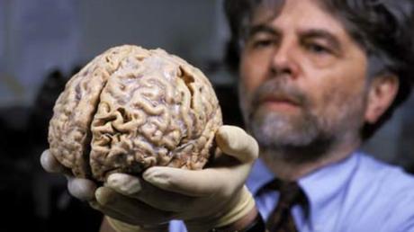 Cerebro reptiliano: ¿tenemos realmente esta estructura ancestral?